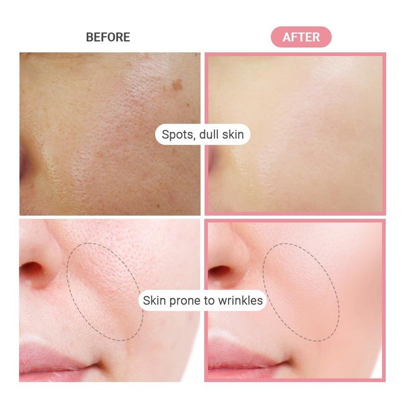 TenZero Hydronic Acid & Niacinamide Heart Serum Pad – Made in Korea - Blaire Shops